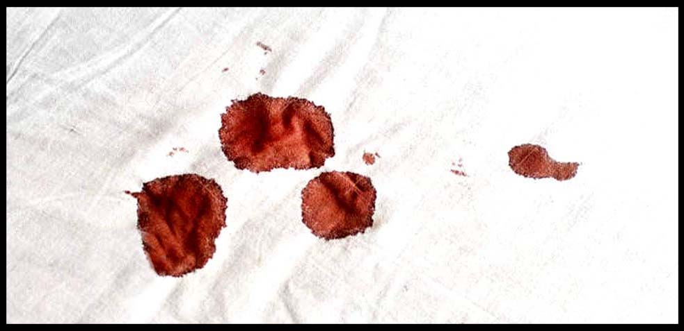 ¿Cómo quitar las manchas de sangre seca de la ropa?