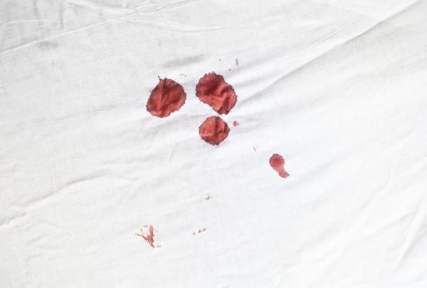 manchas de sangre seca de las sábanas